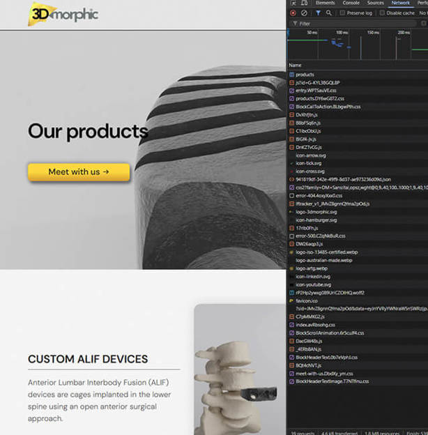 Lazy Loading & Performance Optimisation