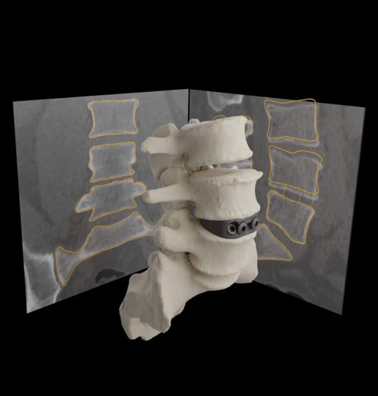 3D Morphic